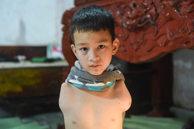 anh (2)
