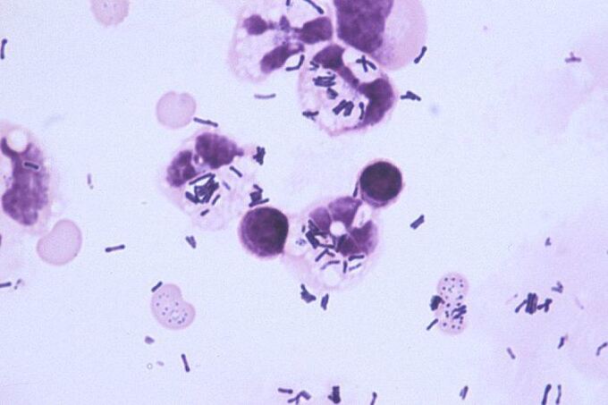 Vi khuẩn Brevibacterium dưới kính hiển vi. Ảnh Alchetron