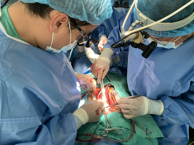 Ê-kíp bác sĩ tham gia phẫu thuật ghép tim ở Bệnh viện Trung ương Huế. Ảnh: Thanh Xuân.